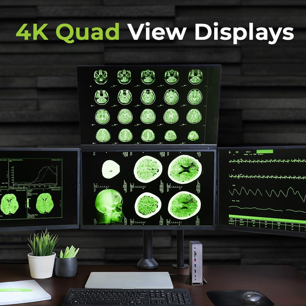 IOGEAR IOGEAR Dock Pro Universal 4K Quad Docking Station GUD3C4K4