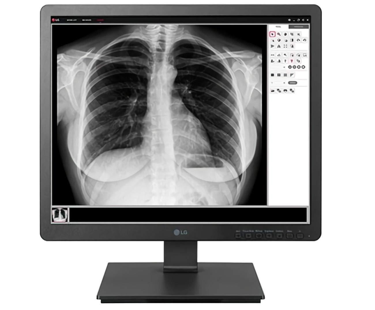 LG LG 19HK312C-B 19\" Clinical Review Monitor, 1.3MP HD Resolution Images, Plastic Housing, DICOM Part 14 Compatible, Flicker Safe, Two-Way Pivot, 1280 x 1024 Resolution, 5:4 Aspect Ratio