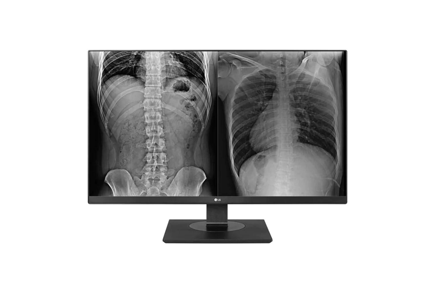 LG LG 27IN 3840X2160 IPS 8MP Clinical Review Monitor