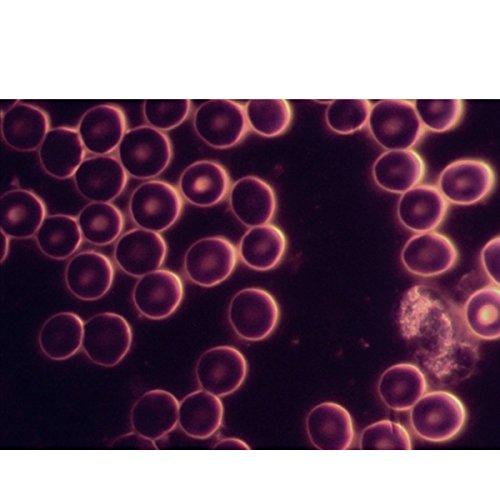 OMAX OMAX 40X-1000X Oil Darkfield Compound Binocular Microscope with 5.0MP USB Digital Camera