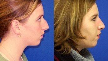 BelgerPhotography Small Spring-Powered Roll-Up/Pull-Down Background ID Photos (Chromakey Blue (Royal))